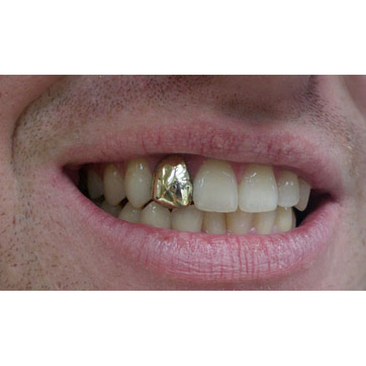 Hip Hop Hollow Open Face Teeth Grillz - Sikumi.Lv. Gift Ideas