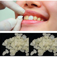 Temporary reusable lumineers - to correct the color and tone of the teeth, Hollywood smile