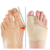 Orthopedic splints for the big toes correction, separators  