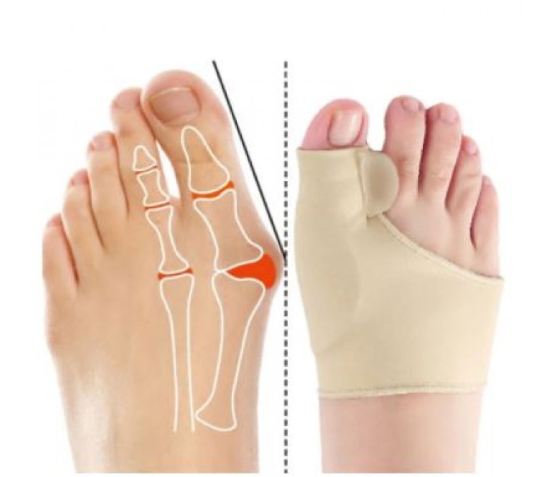 Orthopedic splints for the big toes correction, separators  
