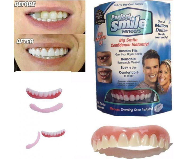 Накладные виниры Perfect Smile Veneers для верхних зубов