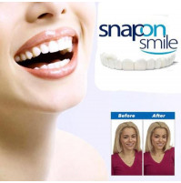 Decorative thin mouthguard, veeneers, onlays for the upper and lower jaw to correct smile, teeth tone Snap On Smile
