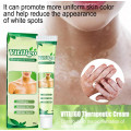 Cream against vitiligo, skin pigmentation, white spots and dark spots on the body Vitiligo Care Cream