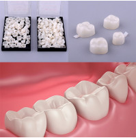 A set of temporary onlays, veneers or crowns, to improve the appearance, Hollywood smile, correct the tone of the teeth